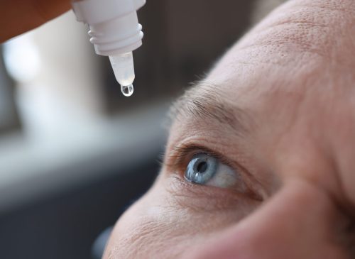 Close-up of a person applying eye drops into their blue eye.